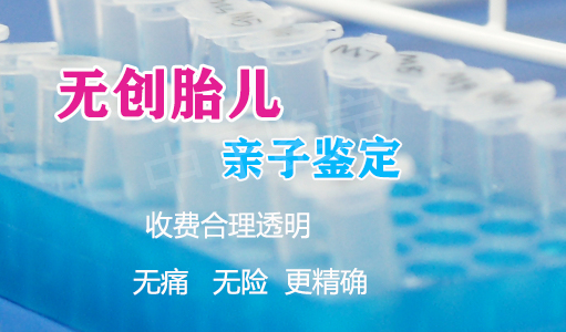 邵阳胎儿亲子鉴定正规的机构到哪里,邵阳孕期亲子鉴定准确吗 邵阳胎儿亲子鉴定正规的机构到哪里,邵阳孕期亲子鉴定准确吗